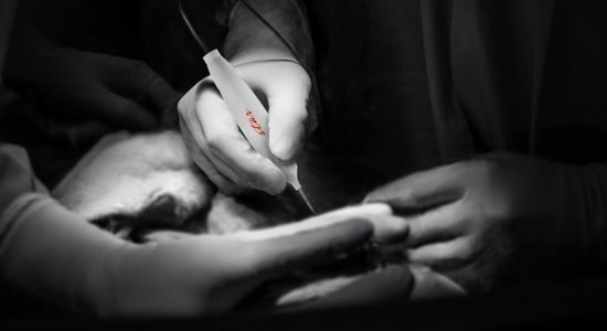 Close-up black and white photo of a doctor's hands performing RFA.